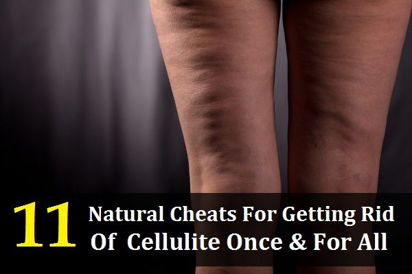 11 trucos naturales para deshacerse de la celulitis una vez y para todos