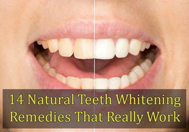14 dientes naturales para blanquear los remedios que realmente funcionan