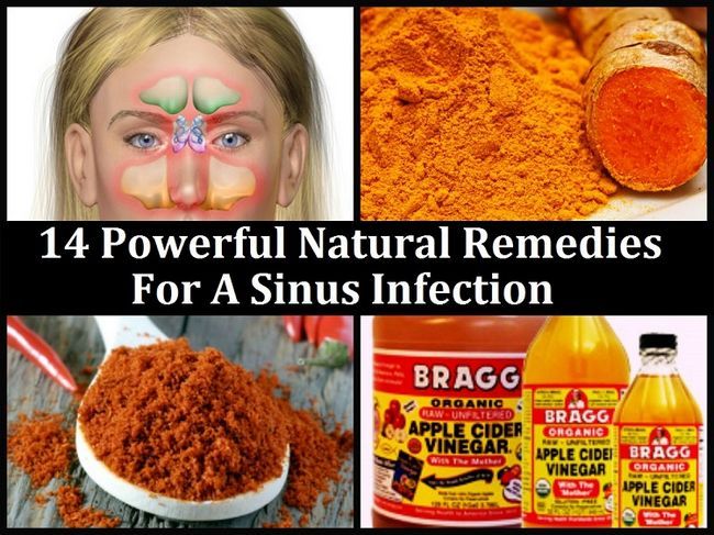 14 Remedios naturales de gran alcance para una infección sinusal