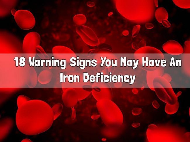18 señales de advertencia que puede tener una deficiencia de hierro