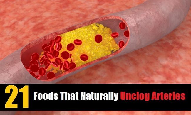 21 alimentos que naturalmente destapar arterias