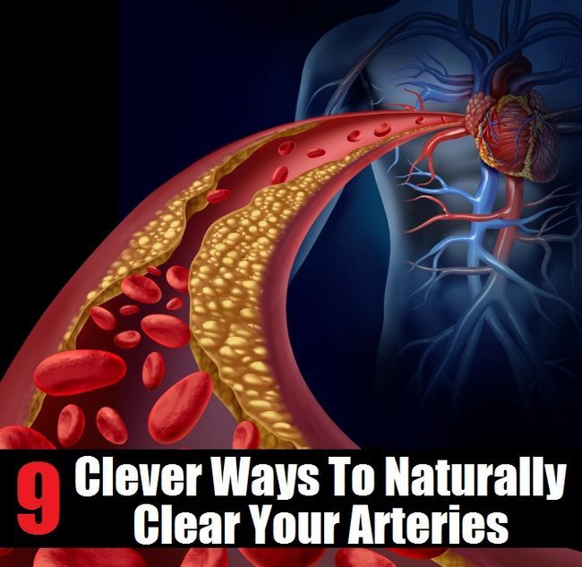 9 maneras de Clever Naturalmente claras Arterias