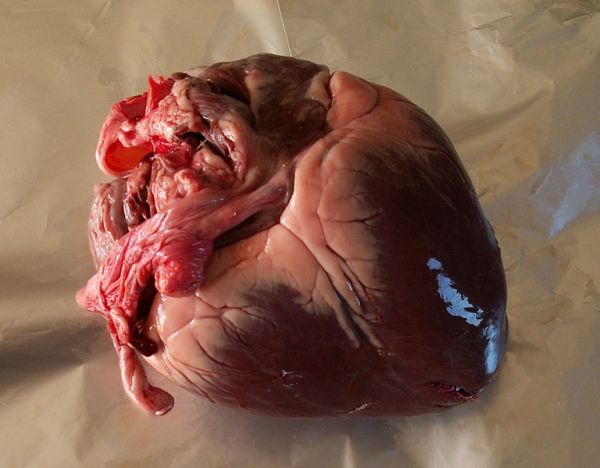 Médicos australianos trasplantar corazones muertos éxito