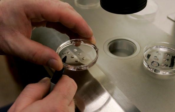California Banco de Embriones Proporciona óvulos donados Para Células Madre
