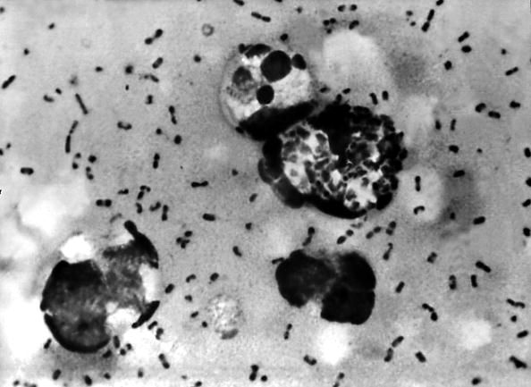 Una mirada microscópica a la bacteria que causa la peste.