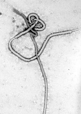 Electrónica de Transmisión Micrografía del virus Ébola. Fiebre Hemorrágica, el ARN del virus