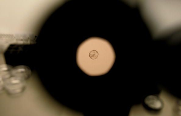 Un embrión humano, como se ve a través de un microscopio.