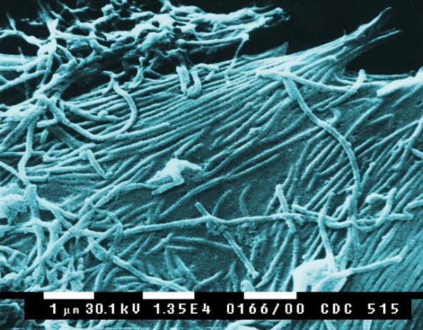 Electrónica de barrido de imagen microscópica de viriones Ébola.