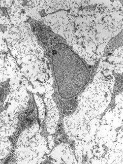 El cáncer que mata las células madre que se ha diseñado en el laboratorio: probado en ratones