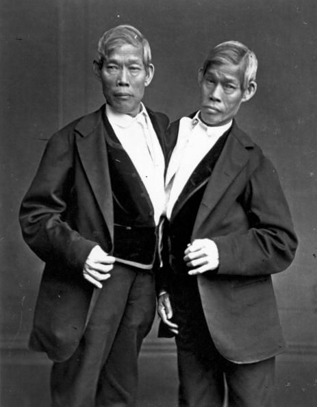 Chang y Eng Bunker, gemelos unidos que se ganaban la vida en exposiciones y dieron origen a la expresión de los gemelos siameses.