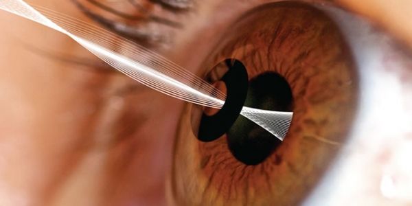 Incrustaciones corneales pueden eliminar el uso de gafas de lectura