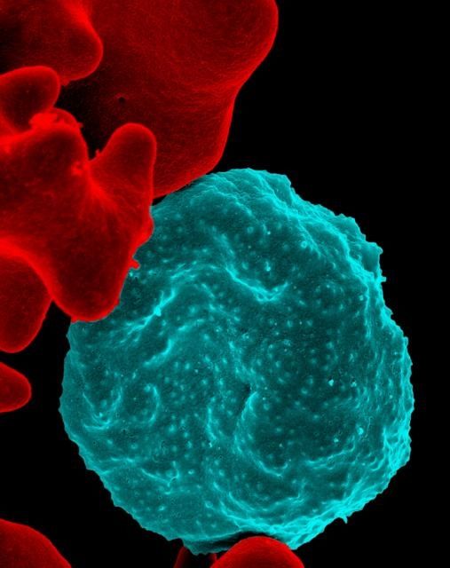 Malaria infectados glóbulos rojos de la sangre