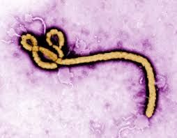 Ébola en los EE.UU.