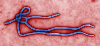 Virus del Ébola, magnificada