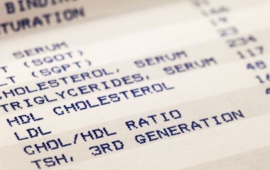 Examen de colesterol es muy importante para la buena salud en general