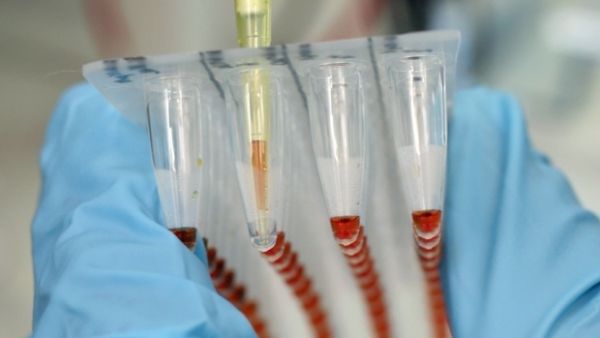 Defecto fatal en las pruebas de ébola podría estar arriesgando vidas