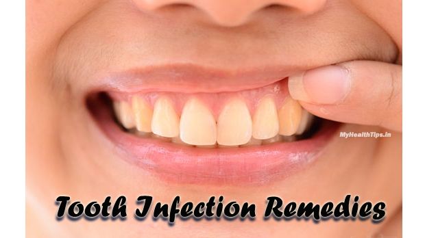 Cómo eliminar una infección del diente en casa
