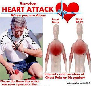 Cómo sobrevivir a un ataque al corazón cuando está solo
