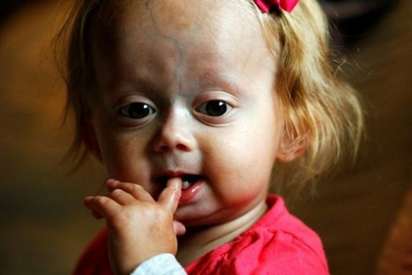 Los datos de investigación sobre enfermedades infantiles raras pueden tener la respuesta para mantener la apariencia juvenil.