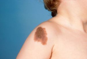 Top lista de 10 problemas más comunes de la piel