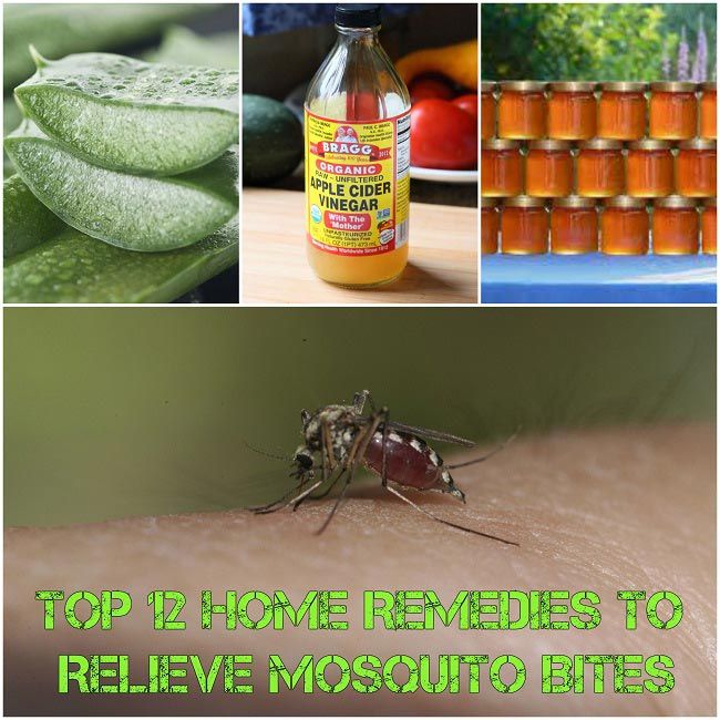 Top 12 Remedios caseros para aliviar el picaduras de mosquitos