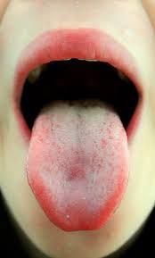 Su lengua le dice a su médico mucho acerca de su salud.