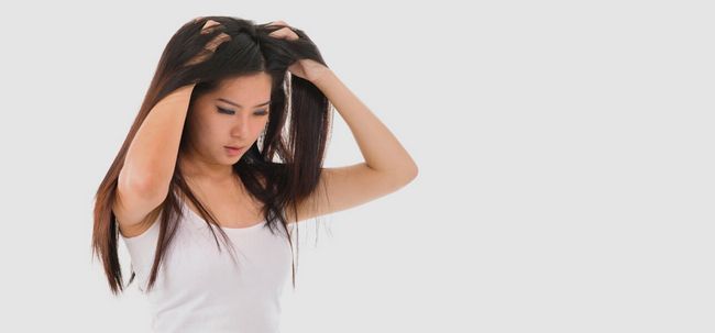 10 Debe seguir consejos para deshacerse de cuero cabelludo seco