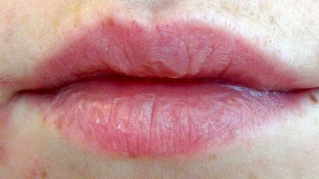 5 mejores remedios caseros para los labios secos y agrietados