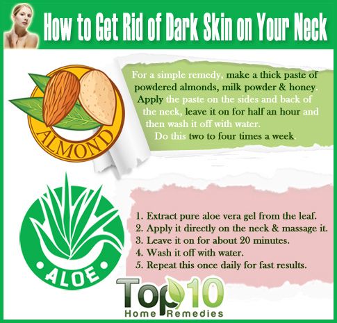 ¿Cómo deshacerse de la piel oscura en el cuello