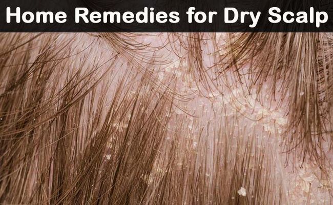 ¿Cómo deshacerse de cuero cabelludo seco con remedios caseros naturales?
