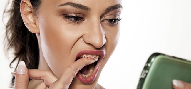 Cómo prevenir el lápiz labial de conseguir en sus dientes