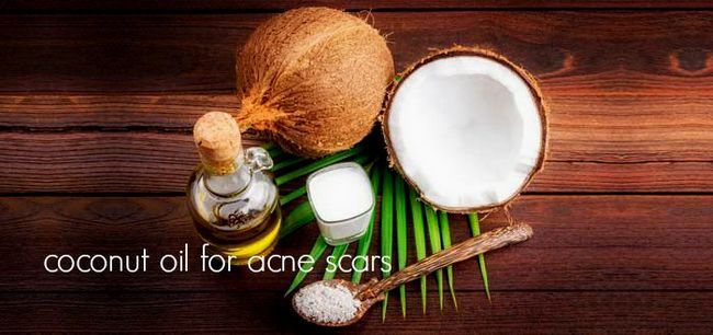 ¿Cómo eliminar las cicatrices del acné con aceite de coco