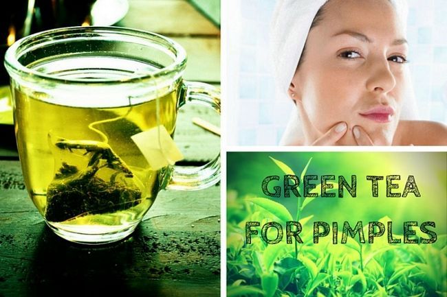 Cómo tratar el acné rápidamente con té verde