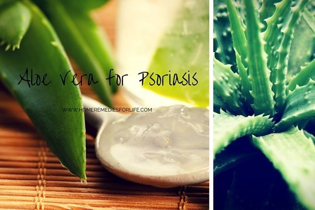 Cómo usar el aloe vera para la psoriasis? (10 métodos)