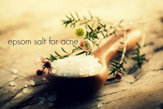 Cómo utilizar la sal de Epsom para el acné (5 métodos)