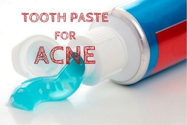 pasta de dientes para el acné