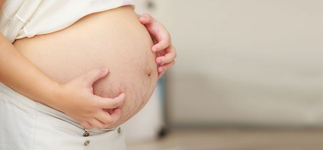 Picazón durante el embarazo - sus causas, tratamientos y remedios caseros
