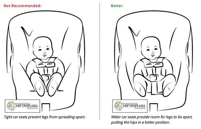 hip-displasia-car-seats.jpg