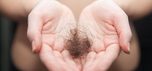 Top 5 curas permanentes para tratar la pérdida de cabello