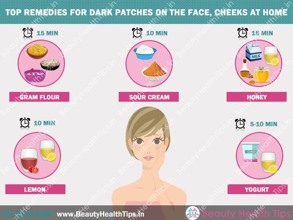Top remedios para manchas oscuras en la cara, las mejillas en el hogar