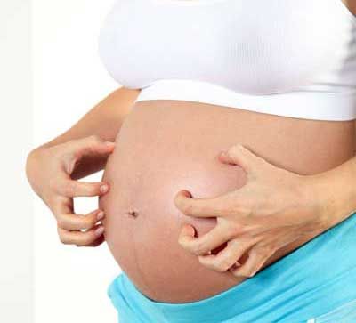 Piel condiciones comunes-durante-el embarazo