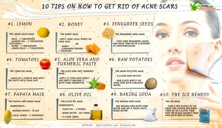 10 consejos sobre la manera de deshacerse de las cicatrices del acné