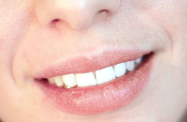 15 mejores remedios caseros para la seca y los labios agrietados