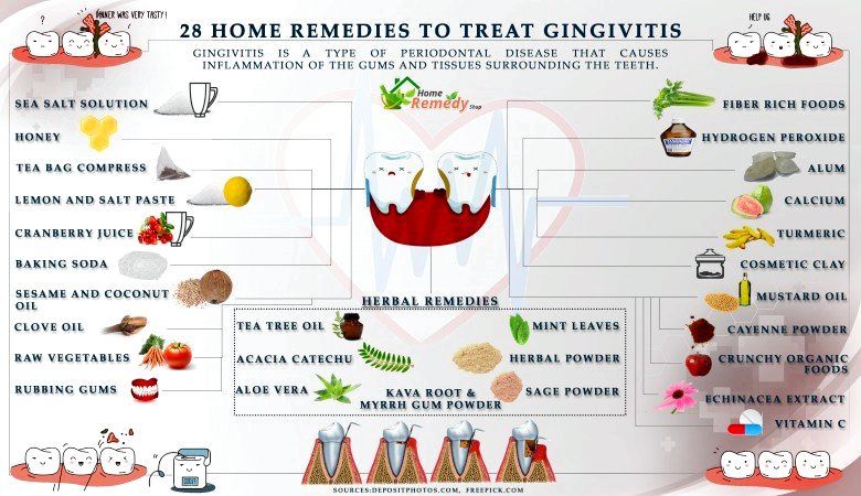 28 remedios caseros para tratar la gingivitis