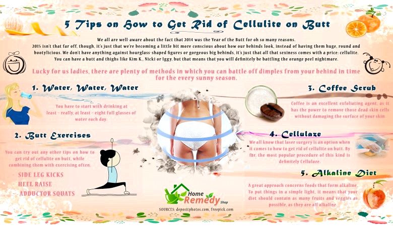 5 consejos sobre cómo deshacerse de la celulitis en Butt