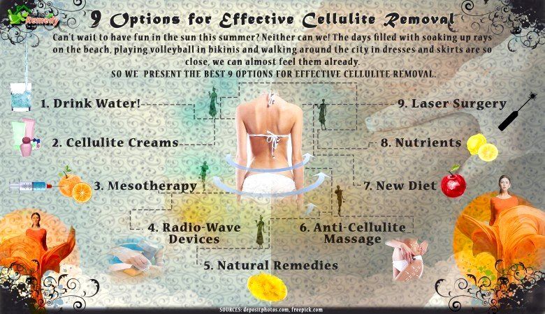 9 Opciones para la eliminación efectiva de la celulitis