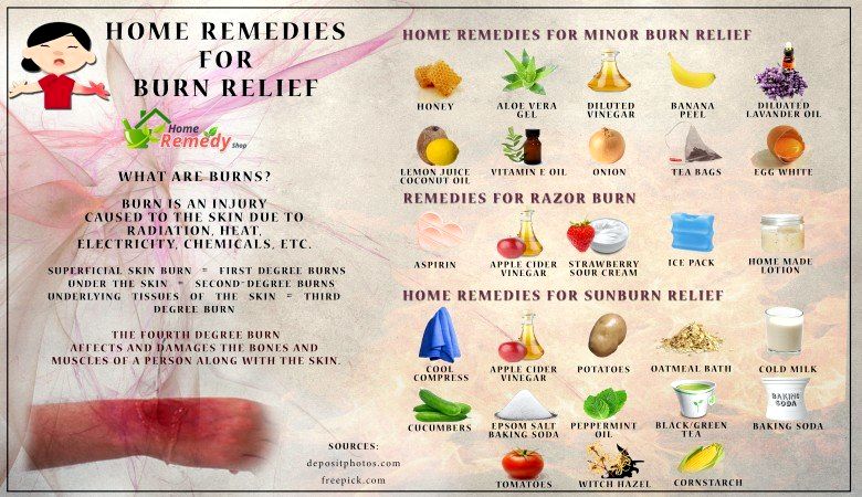 Remedios caseros para el alivio de Burn