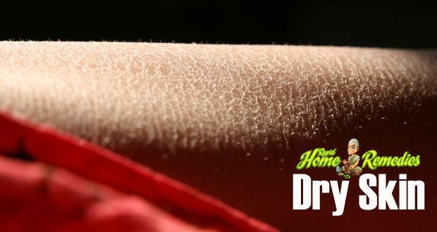 7 mejores remedios naturales para la piel seca