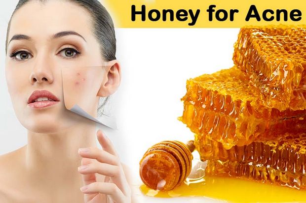 Miel para el acné - utilizar la miel para eliminar las cicatrices del acné y sus