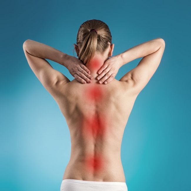 14 potentes remedios caseros para aliviar el dolor de espalda de distancia